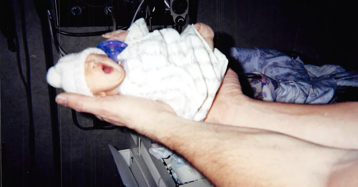 'Cô bé tí hon' sinh ra nằm lọt thỏm trong lòng bàn tay, bị chẩn đoán chỉ sống vài ngày nhưng 12 năm sau lại khiến thế giới kinh ngạc - Ảnh 1