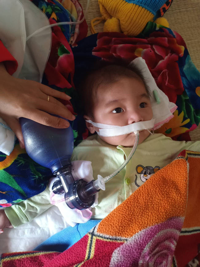 Ánh mắt cầu cứu của bé trai 8 tháng sống phụ thuộc vào máy thở: “Nếu ngừng bóp bình oxy con tôi sẽ ngưng thở” - Ảnh 1