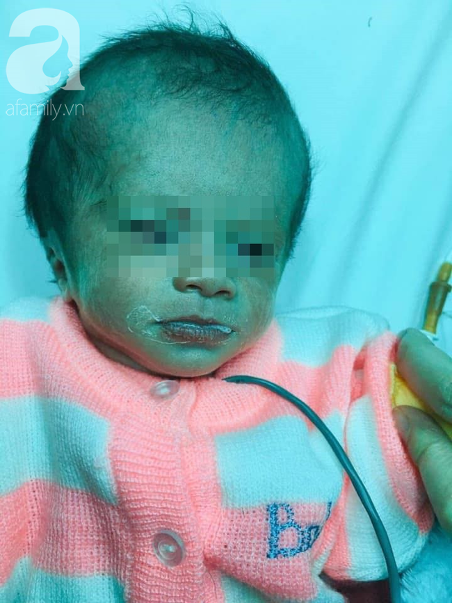 Lâm Đồng: Phát hiện bé gái sơ sinh bị treo trong bọc xốp ngoài rẫy cà phê khoảng 3 ngày, đầu thủng và có dòi trong mũi - Ảnh 1