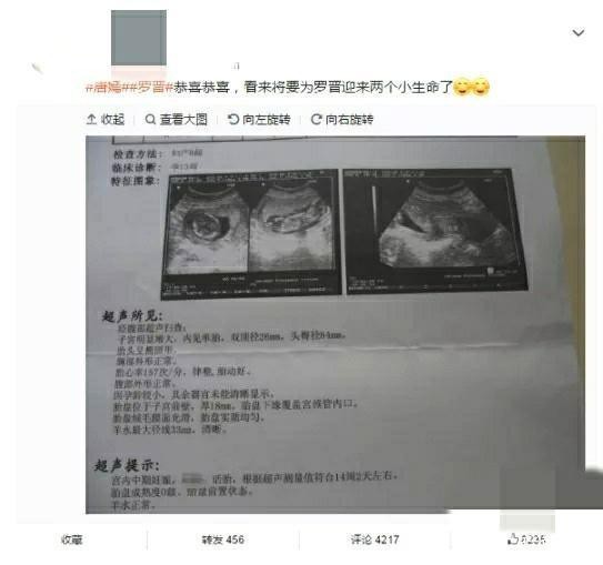 Rò rỉ hình ảnh siêu âm song thai của Đường Yên, vợ chồng La Tấn chuẩn bị đón 2 thành viên mới? - Ảnh 3
