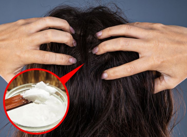 Vì sao nhiều người trẻ tóc bạc sớm và cách đảo ngược quá trình bạc tóc - Ảnh 4