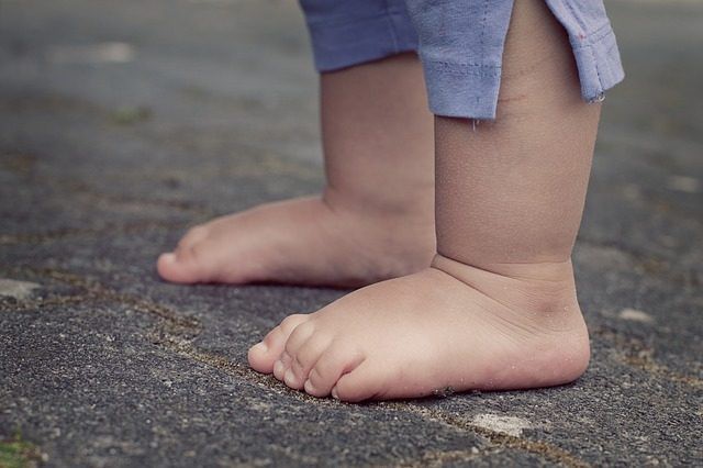 Dấu hiệu lạ ở bàn chân con cảnh báo hiện tượng mà 30% trẻ em Châu Á đang mắc phải - Ảnh 1