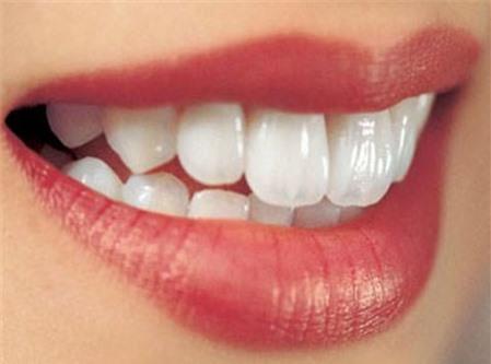 Bọc răng sứ là cách chữa răng hô hiệu quả