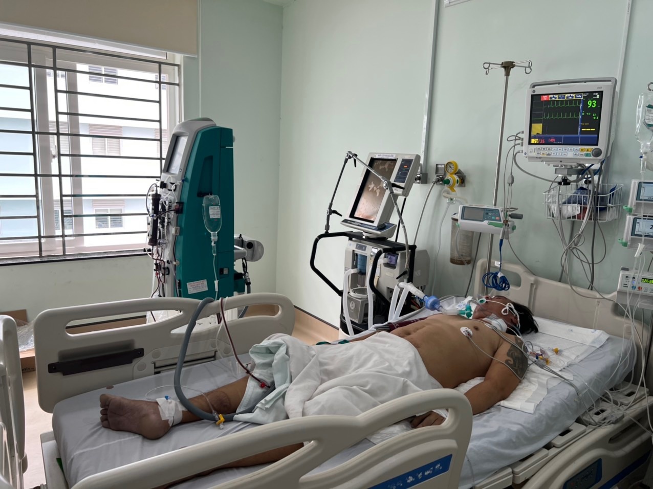 2 trong số 5 bệnh nhân nguy kịch do ngộ độc rượu sau khi đi đám tang ở Kiên Giang đã tử vong - Ảnh 1