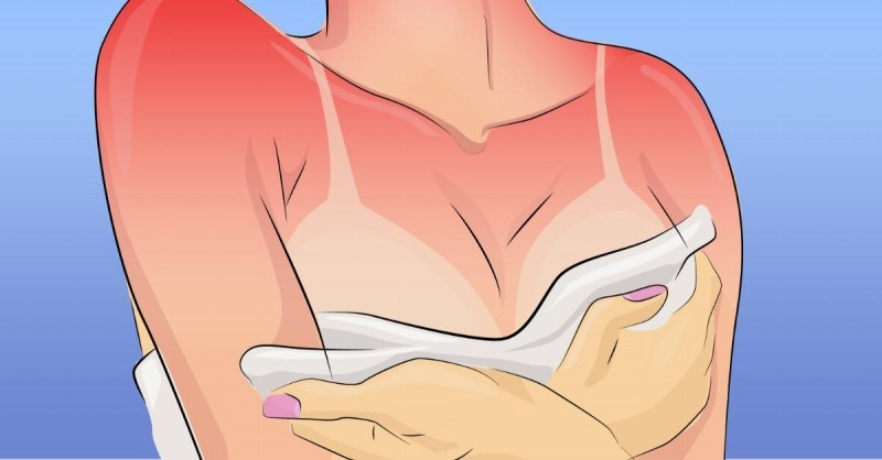 Mặc áo ngực thường xuyên dễ khiến vùng da ngực bị kích ứng.