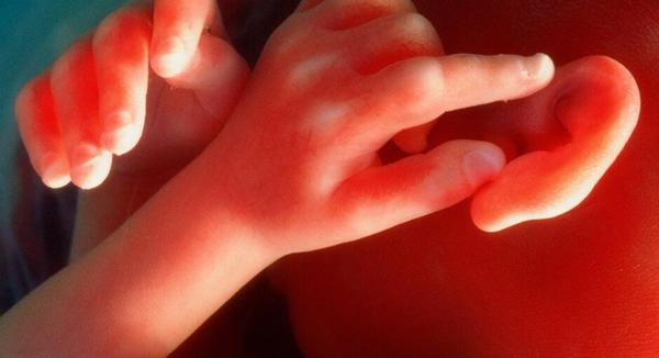 5 loại bệnh ở thai nhi siêu âm cũng 'bó tay' khó có thể phát hiện - Ảnh 2