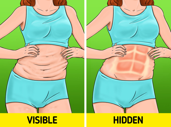 5 dấu hiệu ở bụng phản ánh tình trạng sức khỏe bất thường mà bạn cần lưu ý - Ảnh 1
