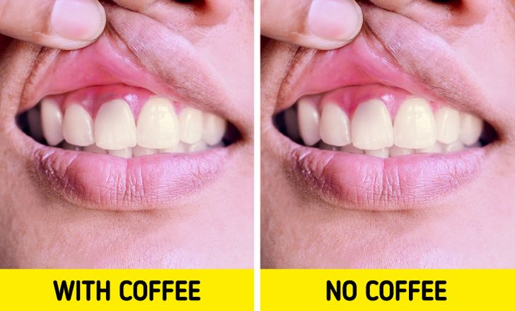 Đừng bỏ uống cà phê đột ngột nếu bạn không muốn gặp phải những ảnh hưởng tiêu cực này - Ảnh 4