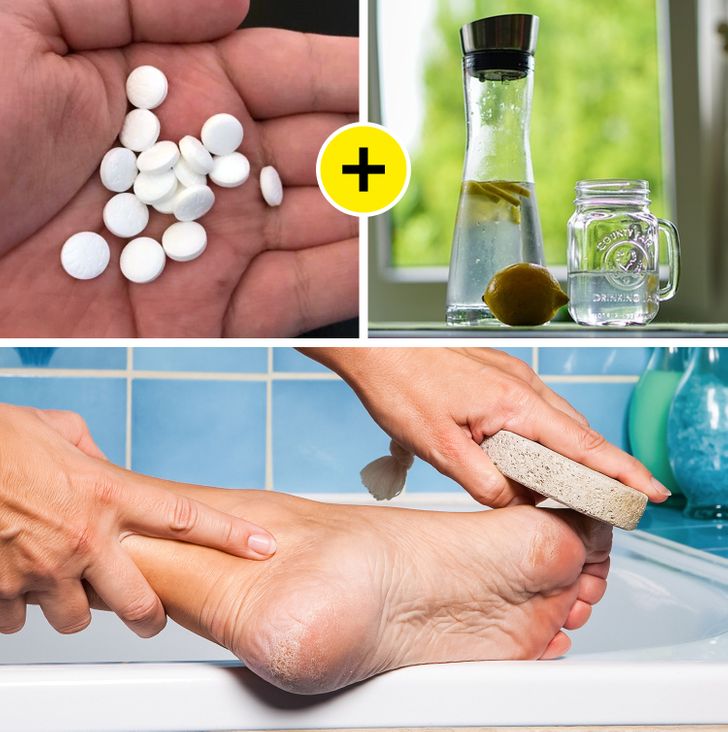 Phương pháp hữu hiệu giúp bạn loại bỏ vết chai để có được đôi chân mềm mại như em bé - Ảnh 1