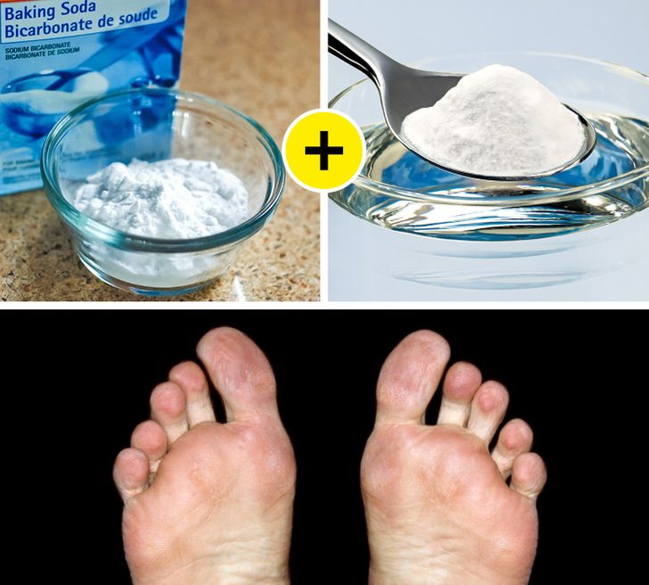 Phương pháp hữu hiệu giúp bạn loại bỏ vết chai để có được đôi chân mềm mại như em bé - Ảnh 2