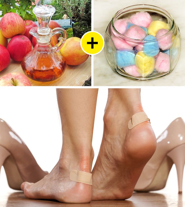 Phương pháp hữu hiệu giúp bạn loại bỏ vết chai để có được đôi chân mềm mại như em bé - Ảnh 5