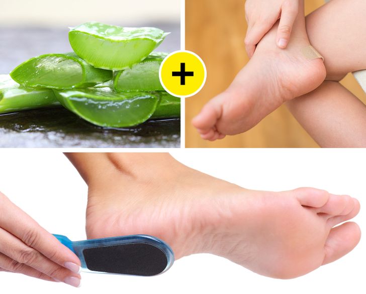 Phương pháp hữu hiệu giúp bạn loại bỏ vết chai để có được đôi chân mềm mại như em bé - Ảnh 8