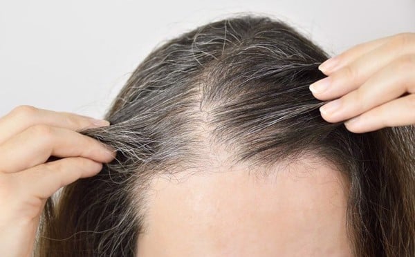 Chuyên gia sức khỏe tiết lộ lý do không nên nhổ tóc bạc: Có 4 cái hại lớn ai cũng cần biết - Ảnh 3
