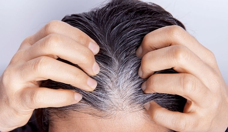 Chuyên gia sức khỏe tiết lộ lý do không nên nhổ tóc bạc: Có 4 cái hại lớn ai cũng cần biết - Ảnh 4