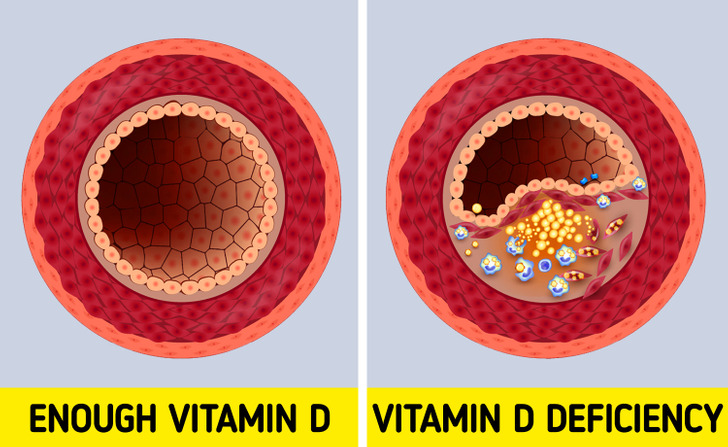 Cơ thể bị hủy hoại, sức khỏe bị đe dọa nghiêm trọng đến thế này nếu bạn đang thiếu Vitamin D - Ảnh 3