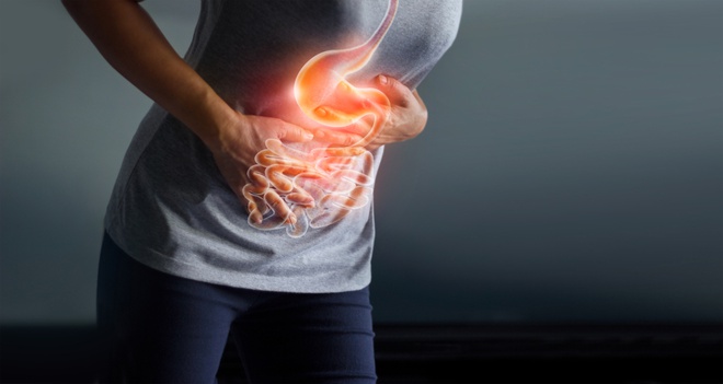 Những điều bạn cần biết về viêm ruột thừa và cách điều trị chúng - Ảnh 4