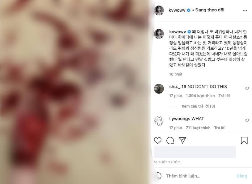 Sốc: Idol Mina (AOA) đăng ảnh nghi cắt tay tự tử lần 3 sau vụ bắt nạt chấn động KPOP, Knet lo lắng cho số phận bi đát của nữ nghệ sĩ - Ảnh 1