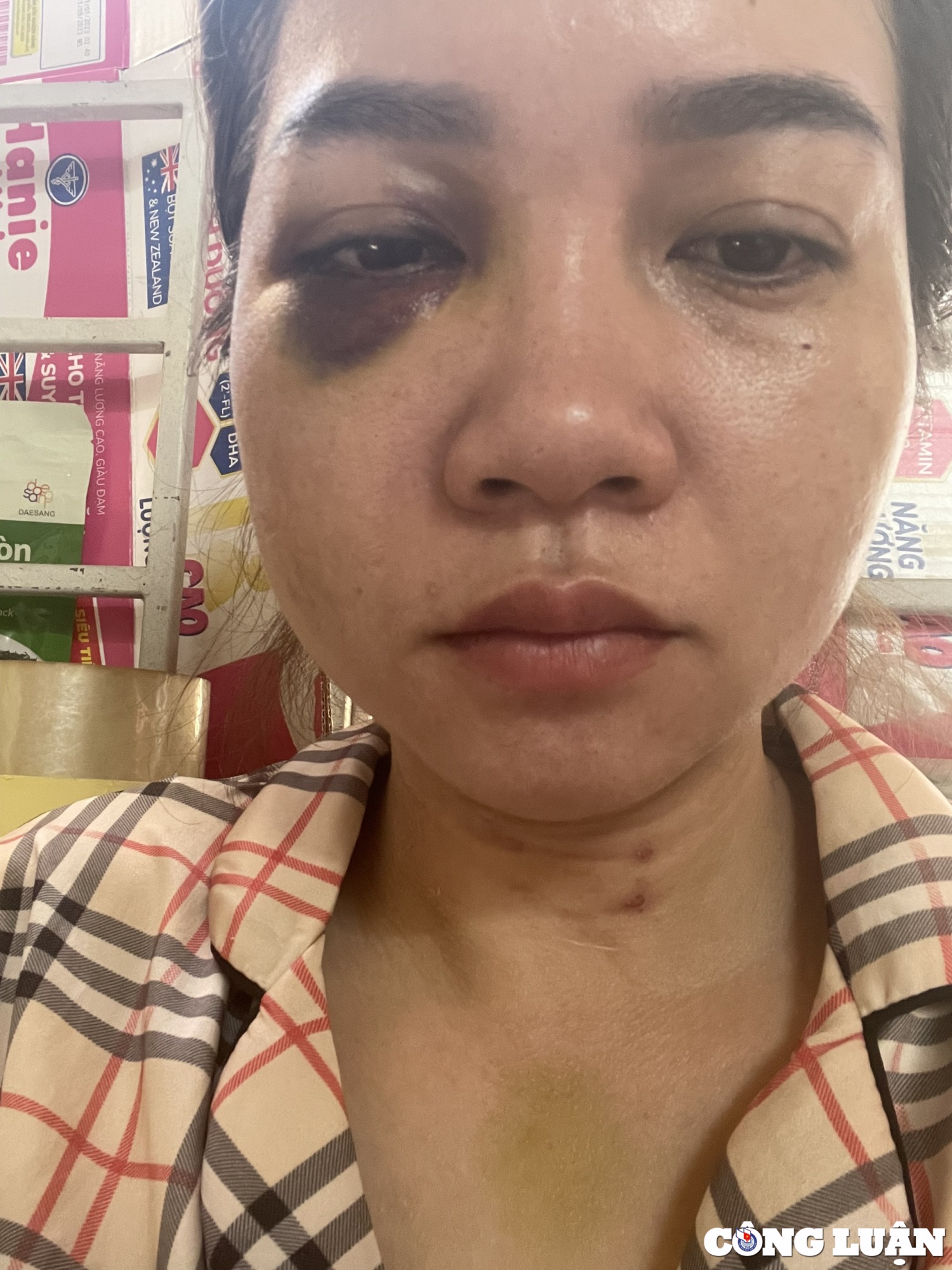 Người phụ nữ ở Quảng Trị bị chồng cũ đánh đập dã man khi đến đón con  - Ảnh 1
