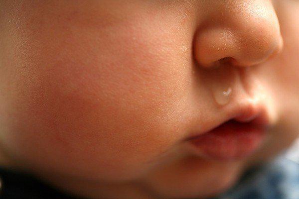Bác sĩ chỉ cách trị sổ mũi cho trẻ sơ sinh tại nhà không cần dùng thuốc - Ảnh 1