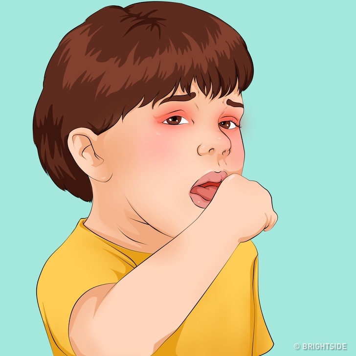 Cách đơn giản nhận biết các bệnh thường gặp ở trẻ em thông qua những dấu hiệu cơ bản  - Ảnh 3