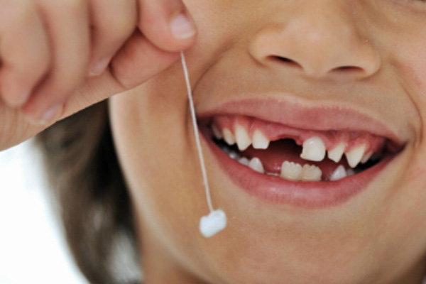 Cha mẹ có nên nhổ răng sữa tại nhà cho trẻ: Đây là câu trả lời của bác sĩ nha khoa - Ảnh 1