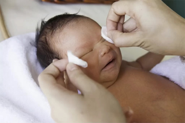 Hiểm họa khôn lường từ cách chữa ghèn mắt cho trẻ sơ sinh bằng sữa mẹ - Ảnh 3