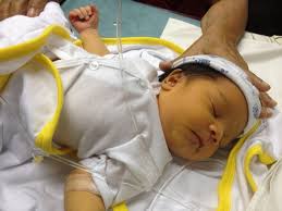 Mức độ nguy hiểm của bệnh vàng da ở trẻ sơ sinh theo ý kiến bác sĩ Nhi - Ảnh 1