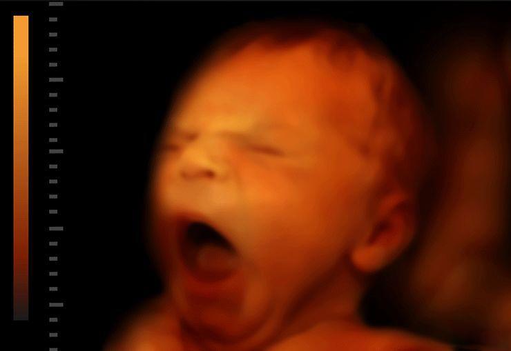 Không chỉ ngủ và đạp, em bé còn biết làm đủ trò thú vị trong bụng mẹ - Ảnh 2