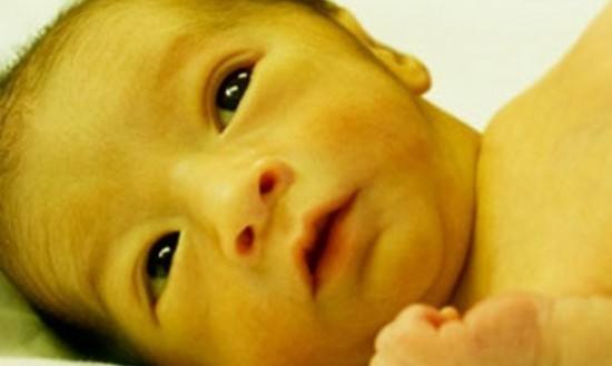 Trẻ sơ sinh bị vàng da: Dấu hiệu nhận biết, nguyên nhân và cách điều trị - Ảnh 1