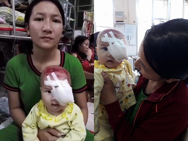 Xót xa bé gái 4 tháng tuổi ung thư hốc mắt, cha mẹ nghèo dốc cạn tài sản chạy chữa cho con - Ảnh 4