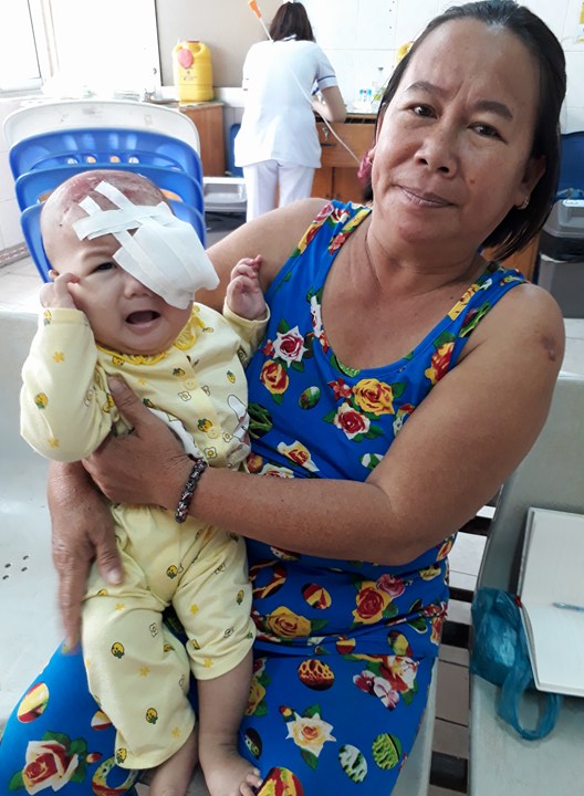 Xót xa bé gái 4 tháng tuổi ung thư hốc mắt, cha mẹ nghèo dốc cạn tài sản chạy chữa cho con - Ảnh 6