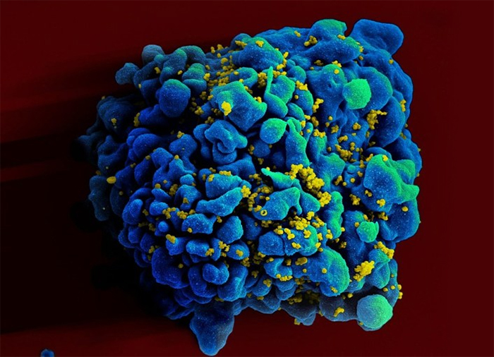 Anh tìm ra biến chủng HIV mới có khả năng lây nhiễm cao và gây ảnh hưởng nghiêm trọng tới sức khỏe - Ảnh 1