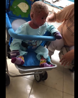 Thương rớt nước mắt, Lam Trường hứa giúp em bé mắc bệnh vảy nến da trăn hết sức có thể - Ảnh 4