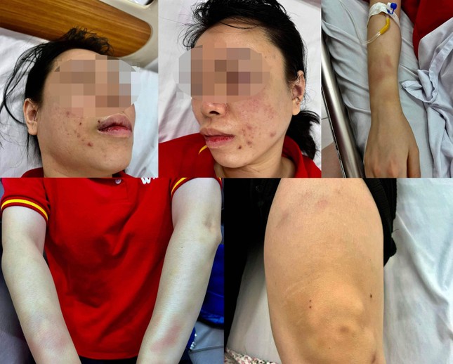 Hà Nội: Trích xuất camera trong vụ người phụ nữ bị chồng cũ đánh đập dã man tại nơi làm việc - Ảnh 2