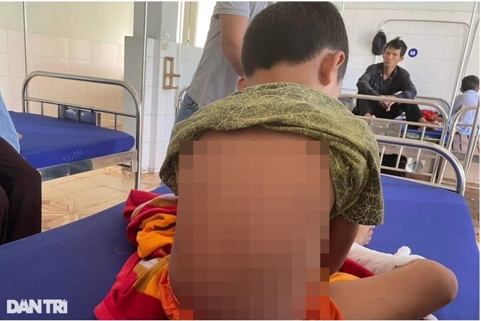 Hoàn cảnh đáng thương của cháu bé ở Quảng Bình bị bố ruột dùng rơm châm lửa đốt chân - Ảnh 2