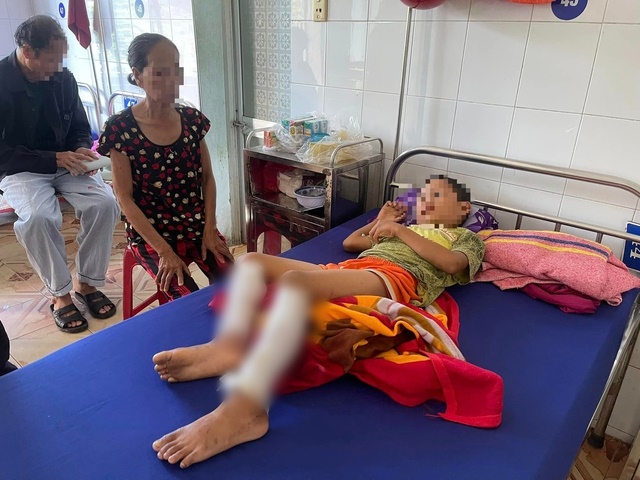 Hoàn cảnh đáng thương của cháu bé ở Quảng Bình bị bố ruột dùng rơm châm lửa đốt chân - Ảnh 1