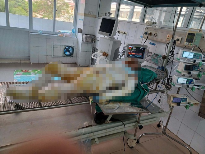 Thông tin MỚI vụ 3 con gái phóng hỏa nhà mẹ ruột: Người mẹ đã thực hiện 2 cuộc phẫu thuật ghép da - Ảnh 1