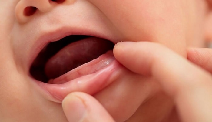 Trẻ 2 tháng mọc răng có nguy hiểm không? - Ảnh 4