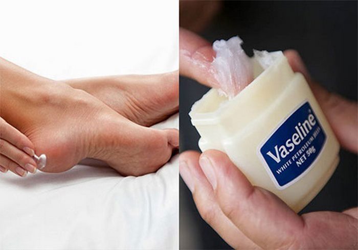 3 cách dùng vaseline trị nứt gót chân không phải ai cũng biết - Ảnh 3