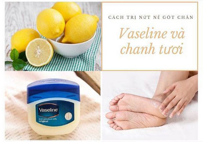3 cách dùng vaseline trị nứt gót chân không phải ai cũng biết - Ảnh 4