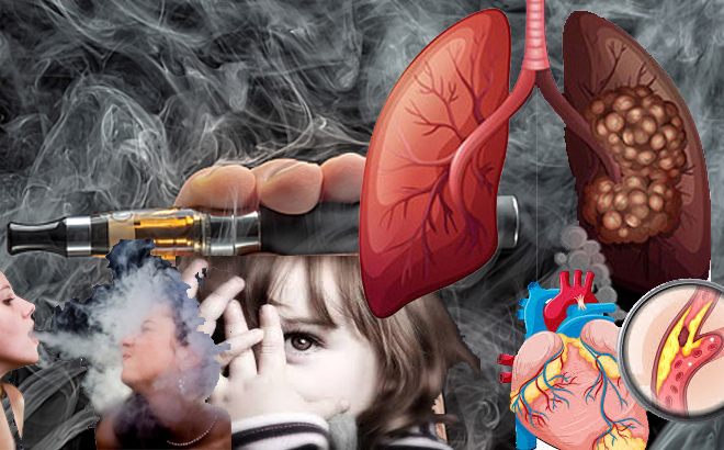 Hút thuốc lá điện tử :Trào lưu giới trẻ khiến phổi bị phá hủy trầm trọng, độc tố nicotin tích tụ gây 5 bệnh khó chữa này - Ảnh 3