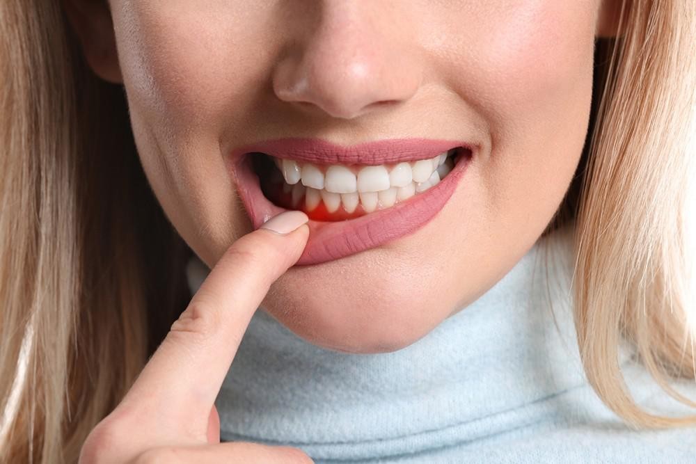 Thấy dấu hiệu này khi đánh răng coi chừng bệnh gan nhiễm mỡ nặng, phát hiện nên khám ngay - Ảnh 2