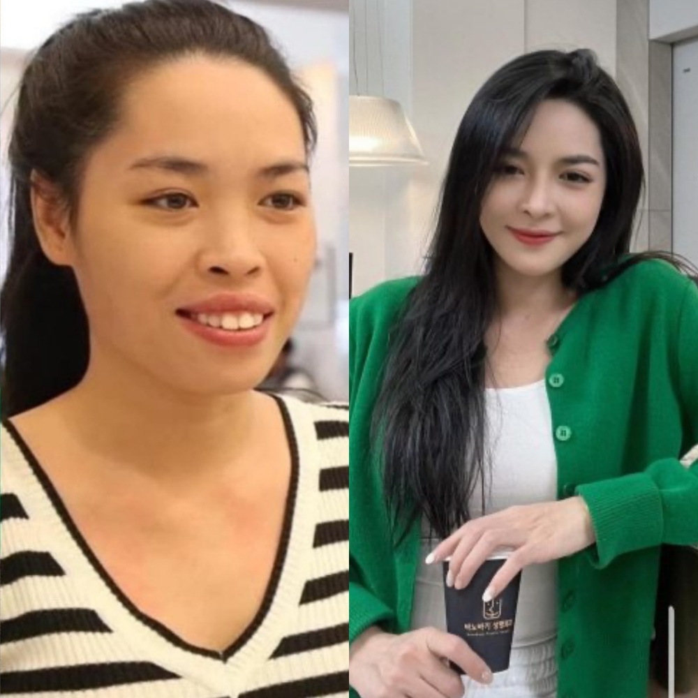 Loạt hot girl Việt khiến fan phải gật gù khen ngợi khi quyết định phẫu thuật thẩm mỹ - Ảnh 7