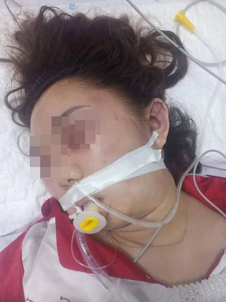 Diễn biến MỚI vụ nữ sinh viên nghi bị bạn trai đánh tử vong tại Lào Cai - Ảnh 2