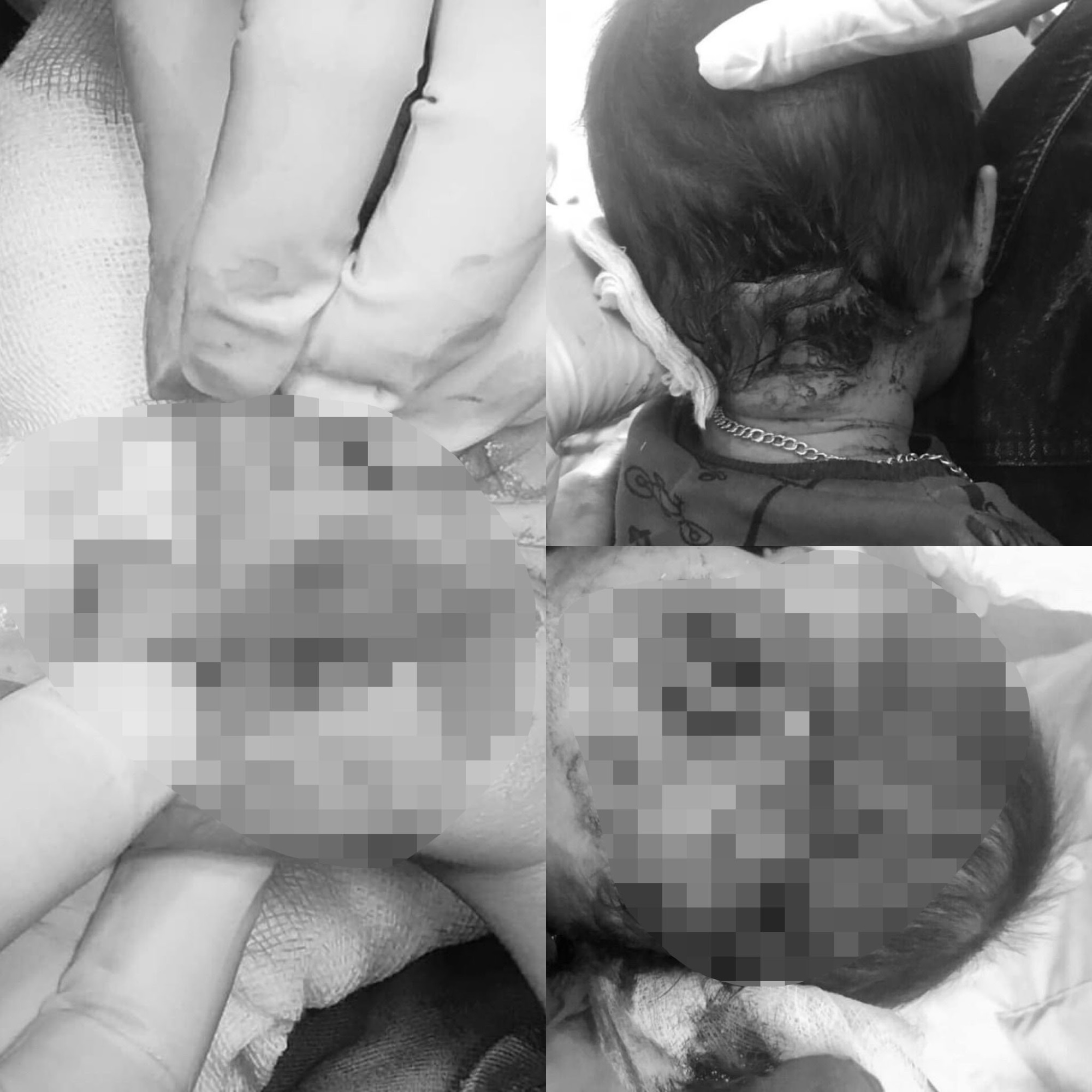 Tuyên Quang: Kinh hoàng chó dữ lao vào tấn công 2 cháu bé nhỏ gây nhiều thương tích nặng  - Ảnh 1