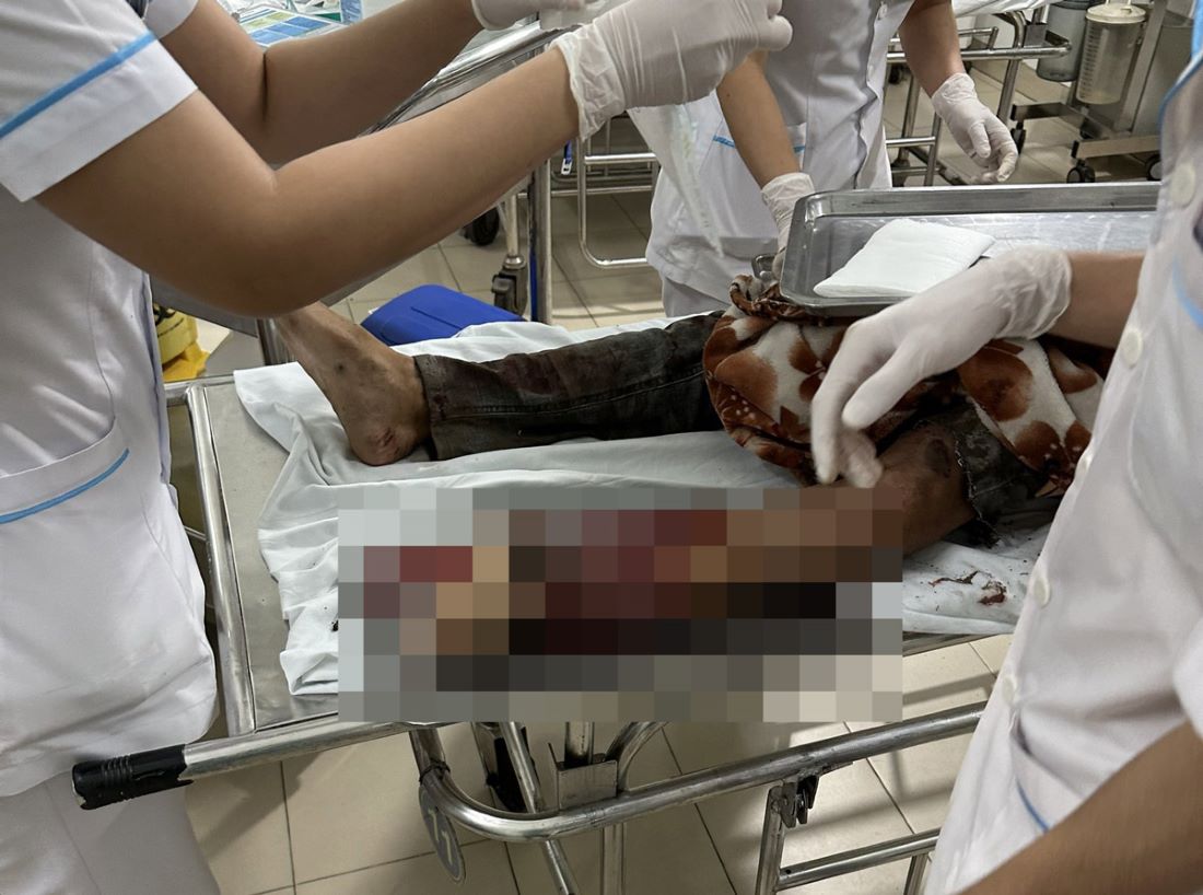 Xót xa chồng bị dập nát bàn chân khi chở vợ từ Đồng Nai về Ninh Thuận thăm 3 con nhỏ - Ảnh 2