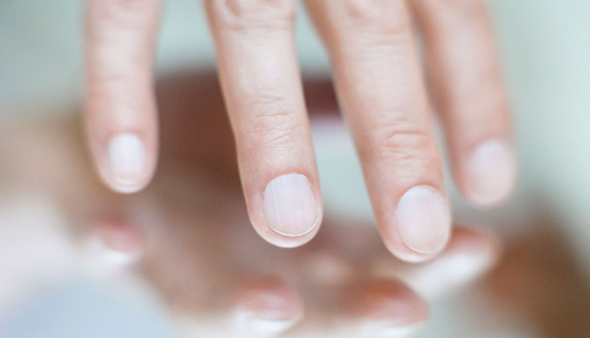 Những dấu hiệu bất thường về móng tay bạn không nên bỏ qua - Ảnh 3