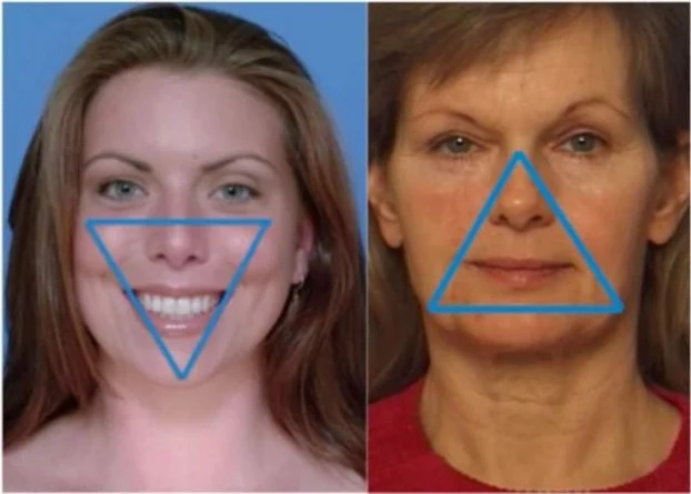 8 dấu hiệu trên khuôn mặt tiết lộ tuổi thật của phụ nữ - Ảnh 8