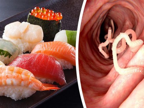 Tín đồ ăn sushi sẽ phát hoảng: Sán dây dài gần 2 mét sống trong bụng người đàn ông vì ăn sushi thường xuyên - Ảnh 1