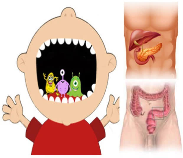 2 loại vi khuẩn trong miệng có thể là 'động lực' của ung thư đại trực tràng và ung thư tuyến tụy, người bị bệnh nha chu càng cần chú ý - Ảnh 1